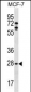 MLF1 Antibody (C-term)